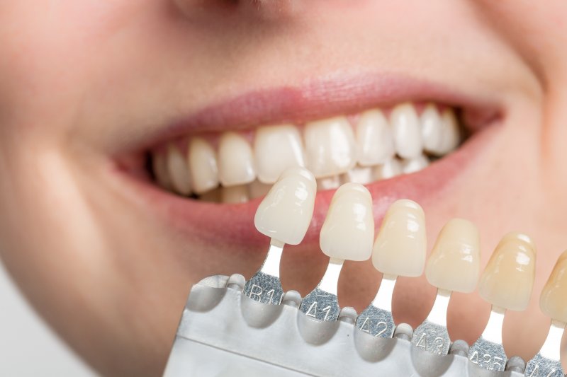 dentist testing veneers in patient's mouth